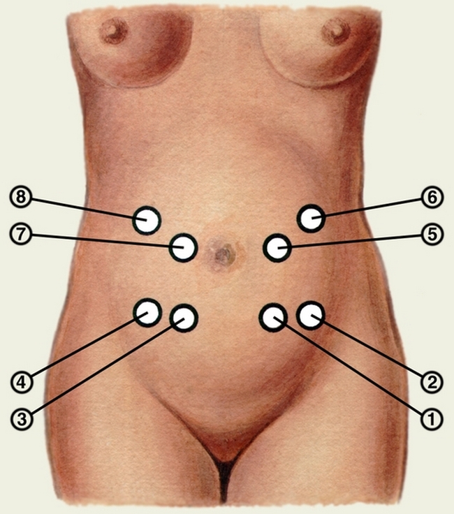 Точки выслушивания
