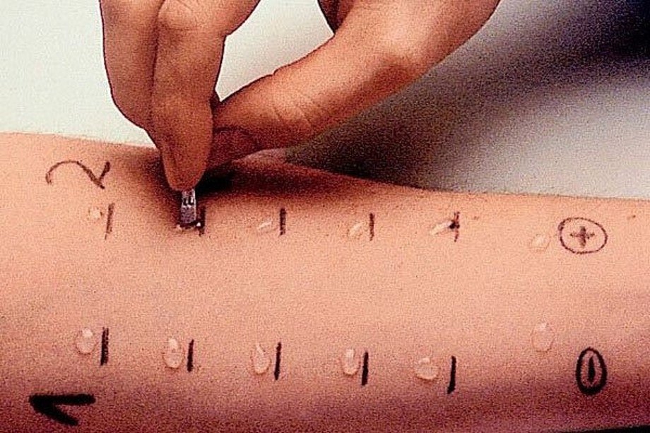 Аллергопробы