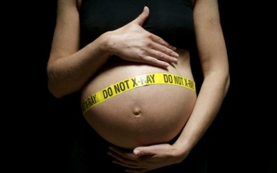 рентген при беременности