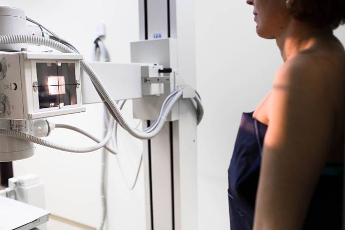 что такое рентген