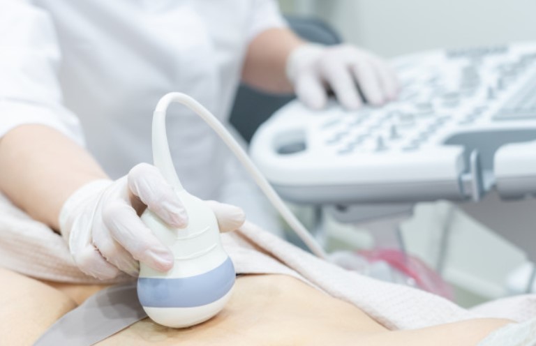 Узи беременной женщины