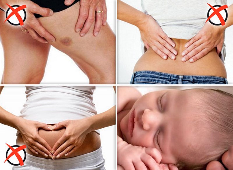 Противопоказания для применения аминокапроновой кислоты