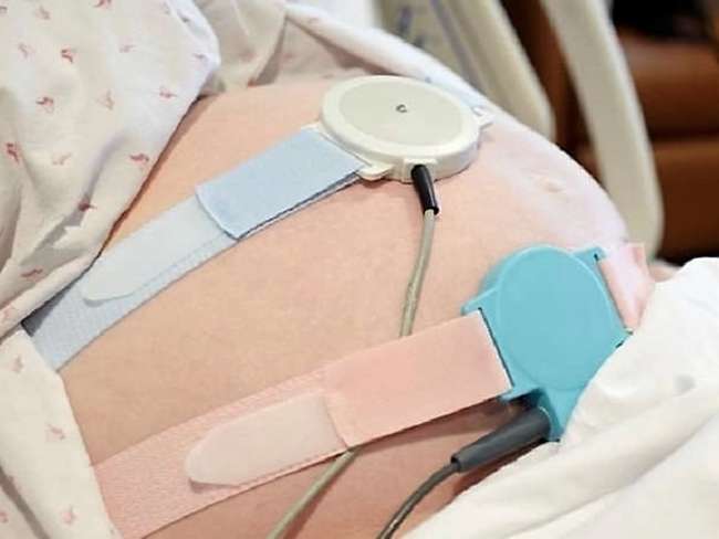 Фонокардиография