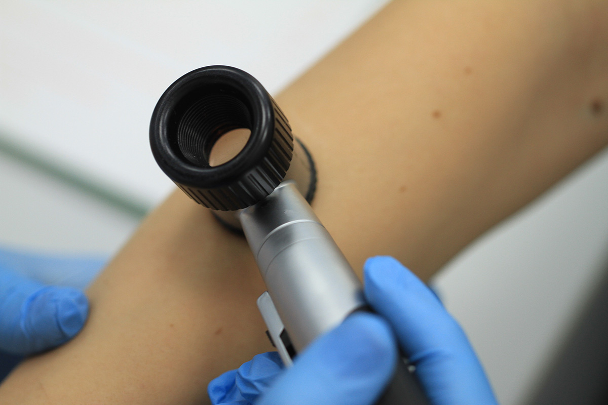 Дерматоскоп