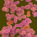 Гемофильная палочка