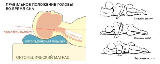Правильное положение головы