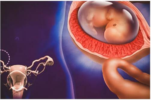 Доплер УЗИ при беременности