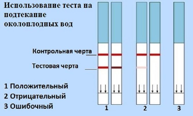 Тест на излитие околоплодных вод