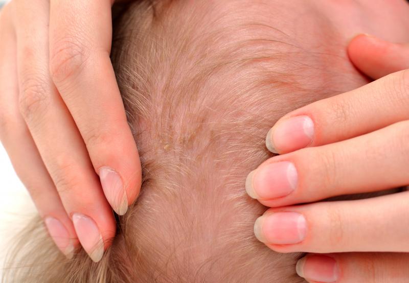 Корочки на голове у грудничка