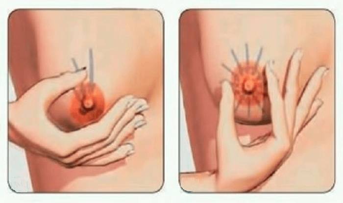 Массаж сосков