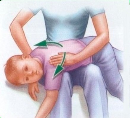 Вибрационный массаж при бронхите