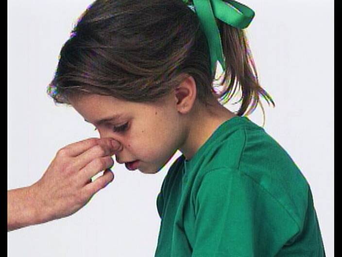 Носовое кровотечение