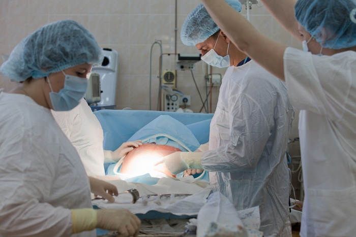 Кесарево сечение