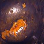 Шейка матки, смазанная раствором Люголя