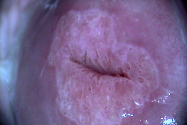 Зона трансформации