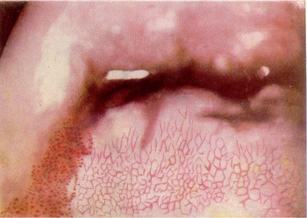 Мозаика и пунктация