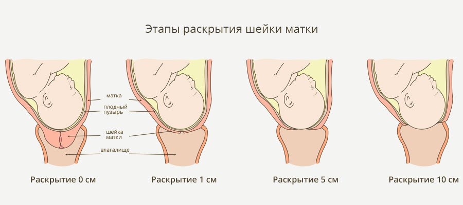 стадии родов