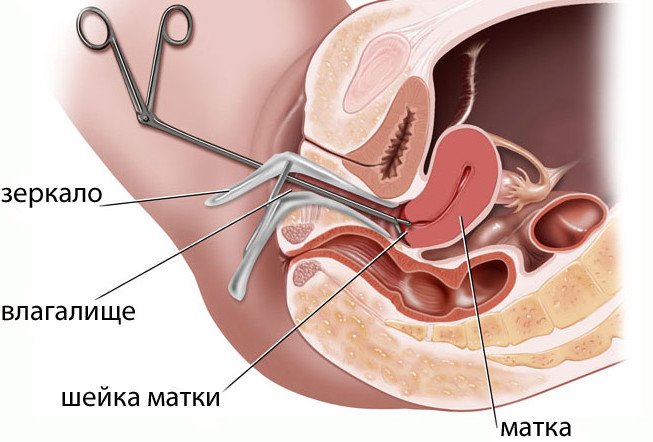 Прицельная биопсия шейки матки