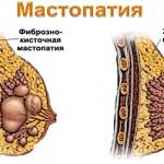 изображение здоровой груди и мастопатии