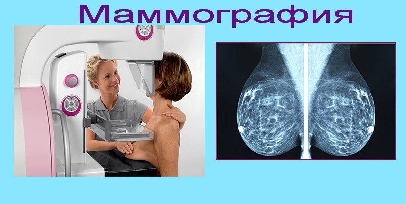 маммография — ход процедуры, снимок
