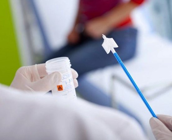 забор мазка на ПЦР