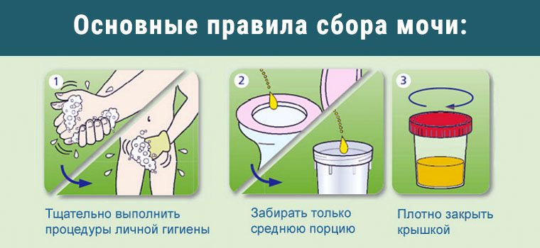 правила сдачи анализов мочи