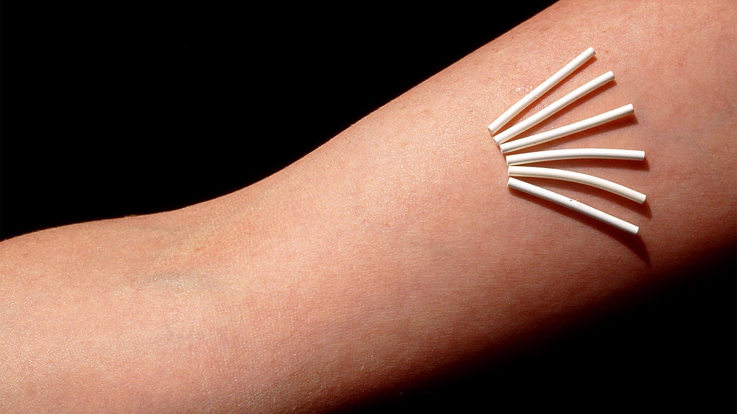 Противозачаточные импланты