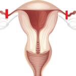 Стерилизация