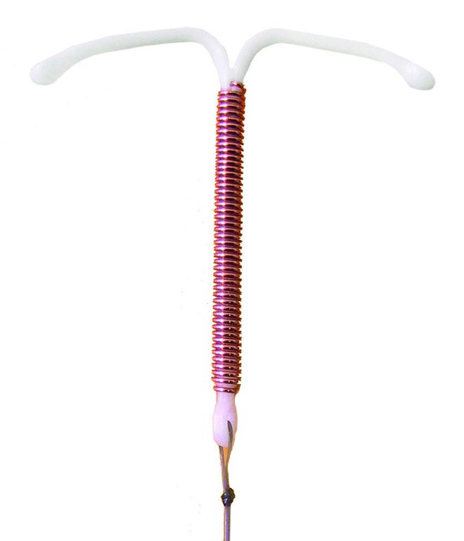 Внутриматочная спираль Т-образная