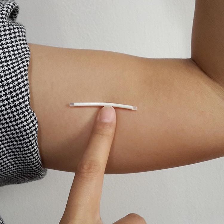 Противозачаточный имплант