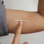 Имплант противозачаточный