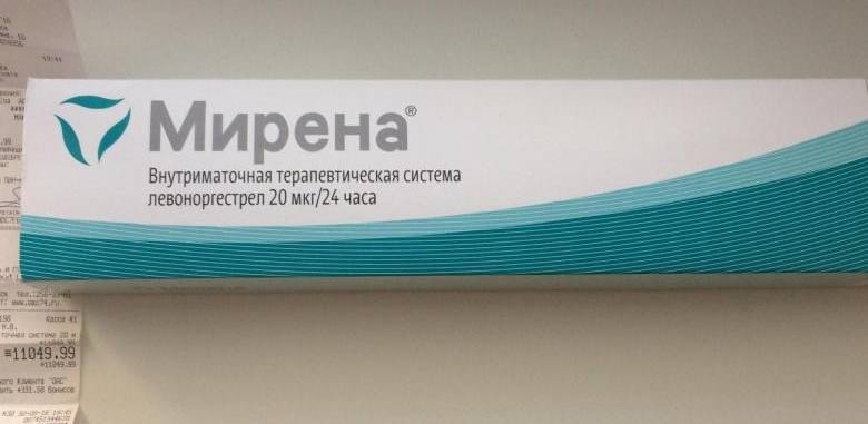 система мирена