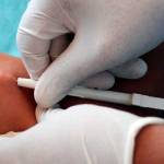 Мужчине под кожу вводится противозачаточный имплант