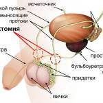 Семявыводящие протоки после вазэктомии (перерезаны и удалёны небольшие фрагменты)