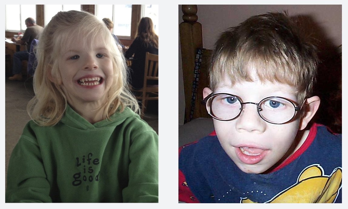 Дети с синдромом кошачьего крика