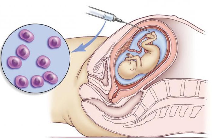 инвазивные методы внутриутробного исследования плода