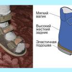 ортопедическая обувь