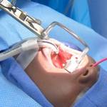 Эндоскопическая операция