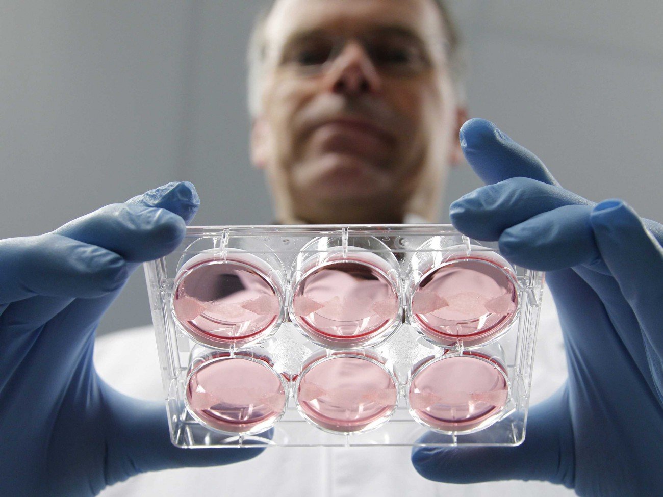Яйцеклетки в пробирке