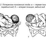 Варианты продольного положения плода