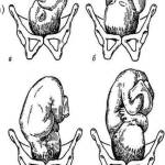 Позиции плода