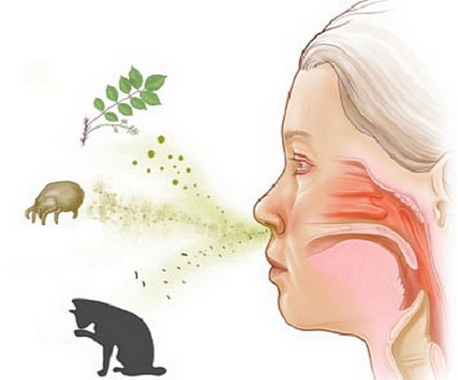 Причины аллергического кашля у детей