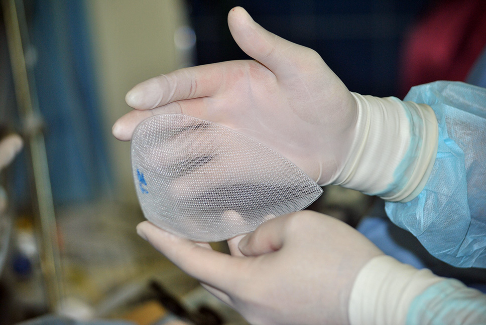 Сетчатый эндопротез