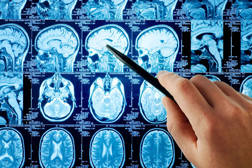 расшифровка мрт