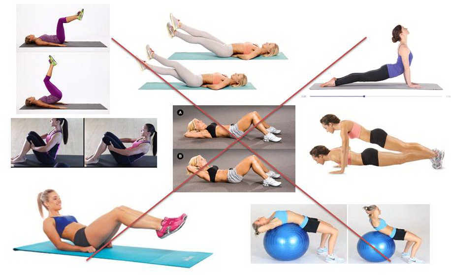 Упражнения, запрещённые при диастазе