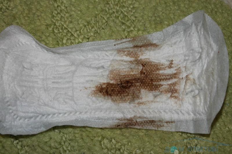 Выделения коричневого цвета