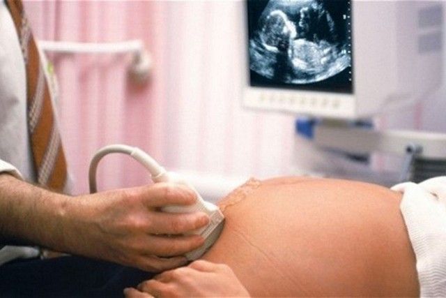 Узи во время беременности