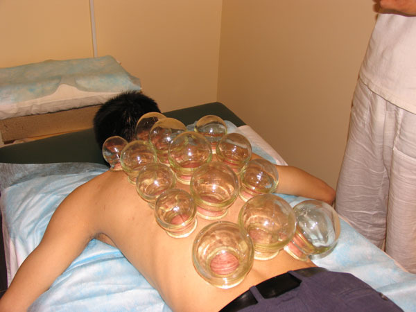 Банки при кашле Банки при кашле