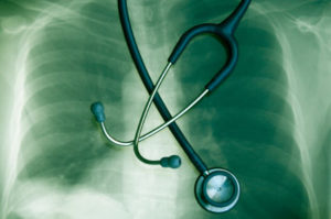 развивается очаговая пневмония развивается очаговая пневмония